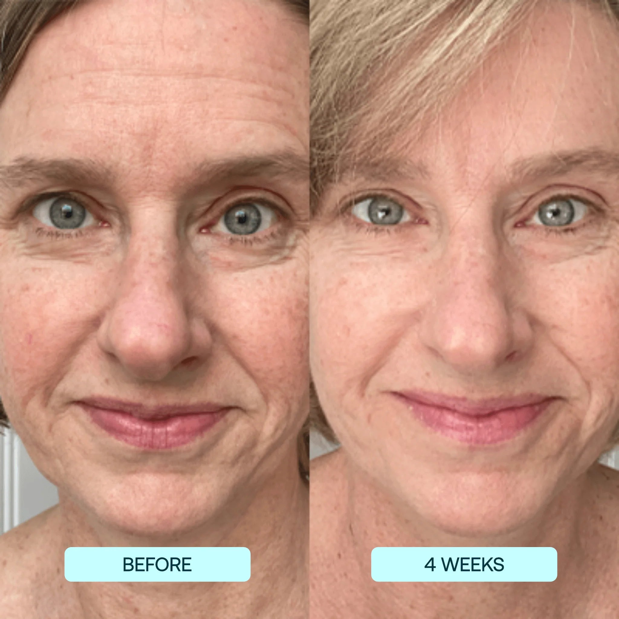 Dermarssance Collagen film