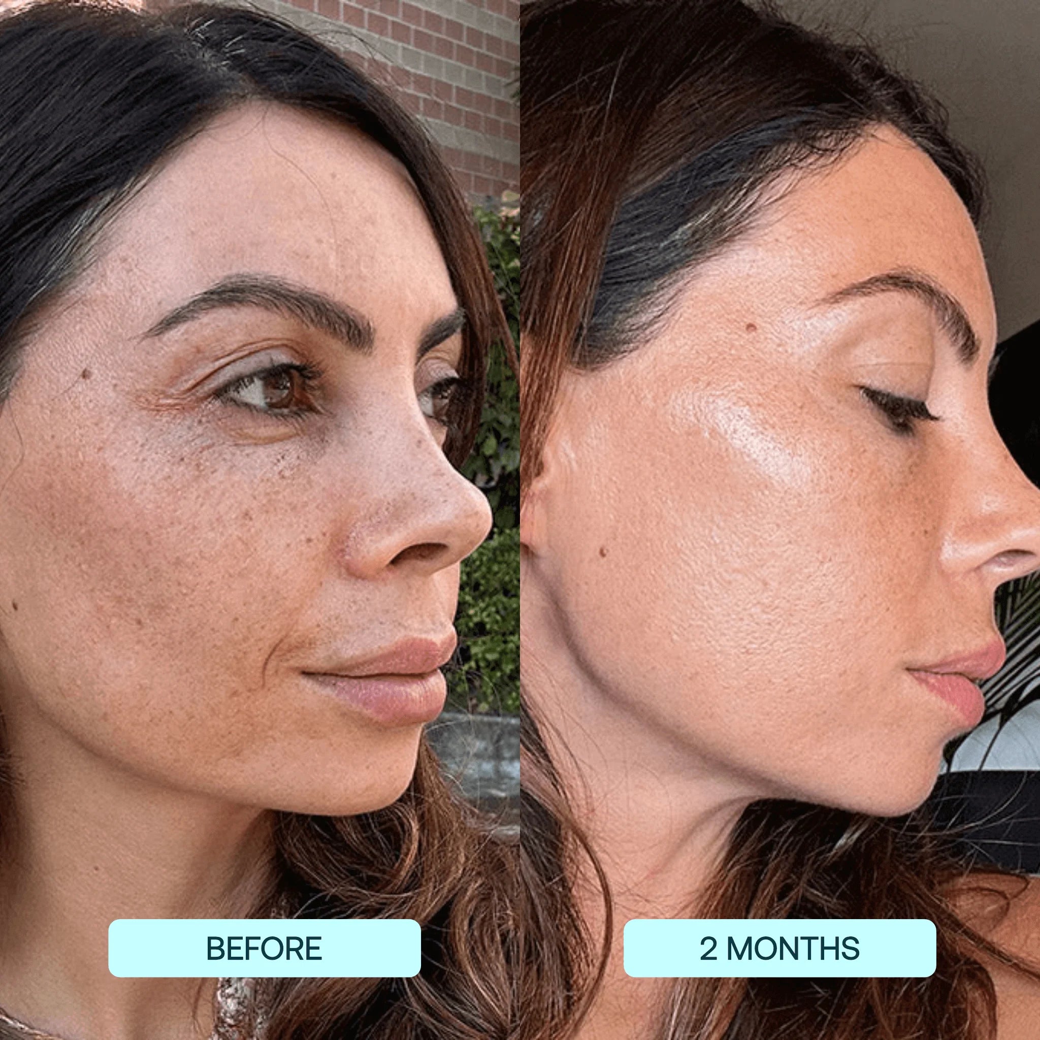 Dermarssance Collagen film