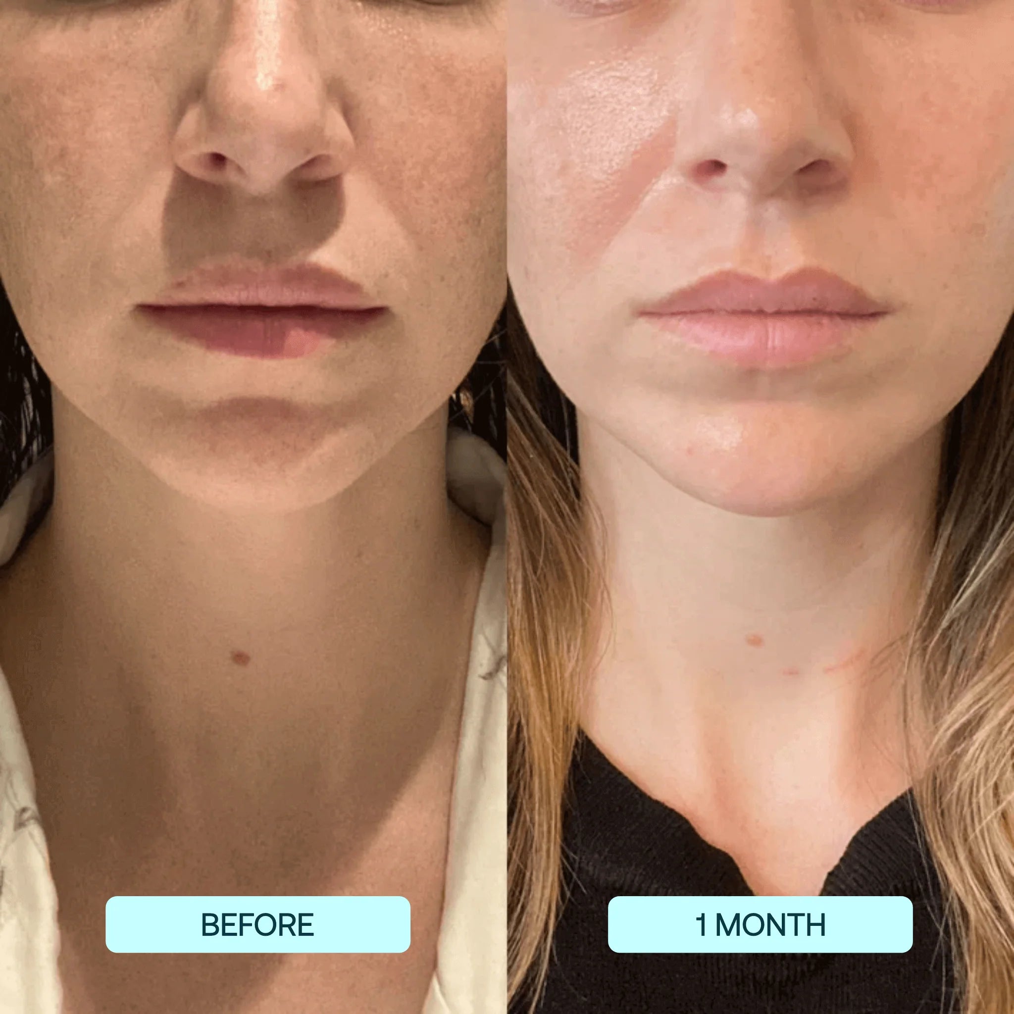 Dermarssance Collagen film